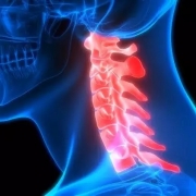 درمان انواع شکستگی مهره های گردنی