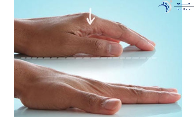 کشش انگشتان برای تقویت تاندون دست